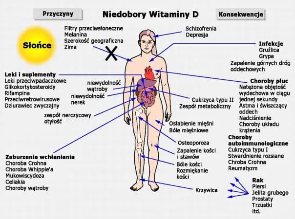 Niedobór wit D3 objawy: jak rozpoznać i uniknąć poważnych skutków